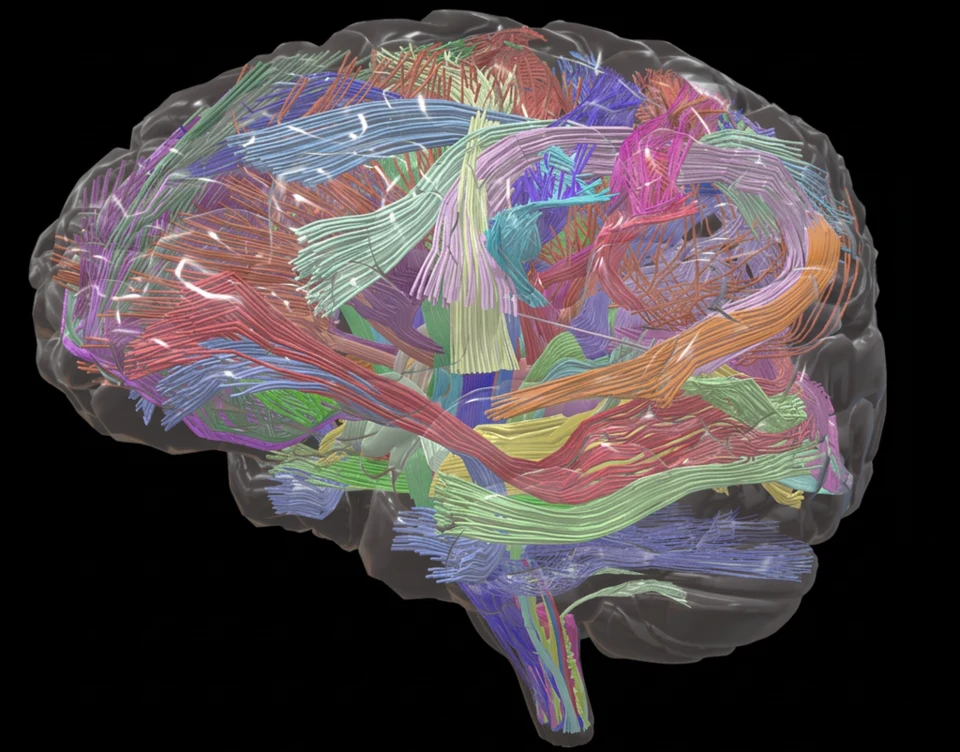 Colored cerebral white-matter fiber bundles from the atlas
