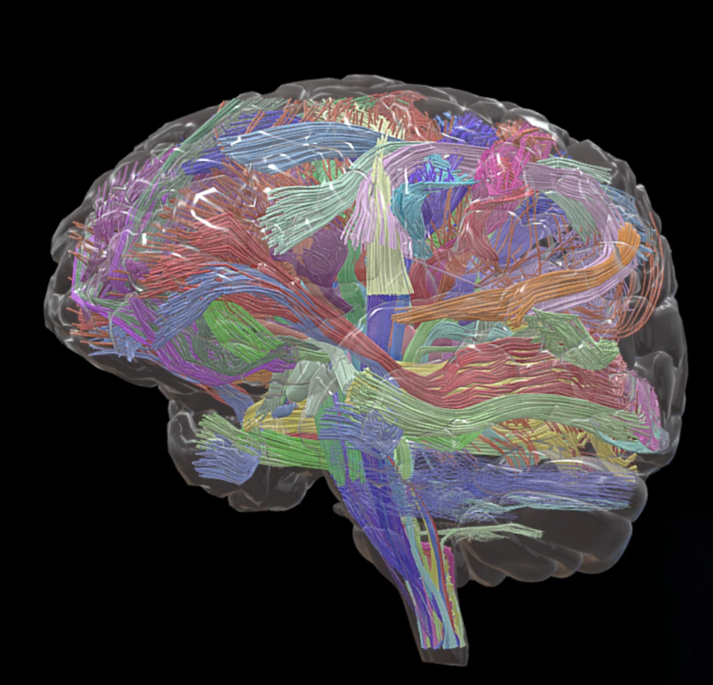 White matter pathways with surrounding brain context, taken from the supplied horizontal-menu screenshot
